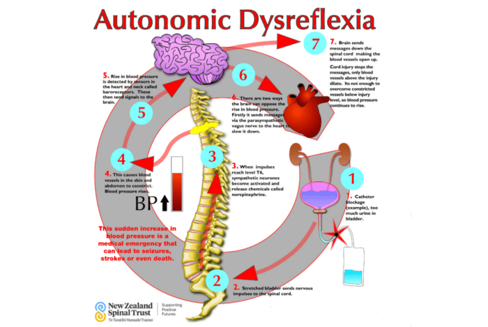 Mr explain position terms drag into problem nurses physiology need lungs collapsed transcribed text show inhale tries